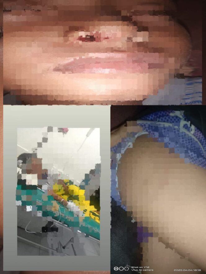 
Diminta Kapolda Sulteng Copot Kanitreskrim Polsek Bualemo Dugaan (IS.J) Kebal Hukum Karena Teman Dekat Kanitreskrim Polsek Bualemo.