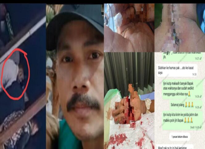 
					Sampang Memanas: DPO Diduga Dilindungi, Kapolres Diam, Wartawan Korban Nyaris Tewas!