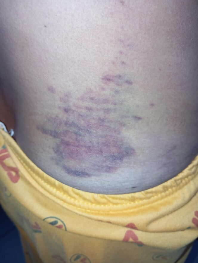 
Korban Dipanggil Lagi, Penanganan Kasus Suarni Sapikerep Probolinggo Dinilai Berputar Tanpa Arah