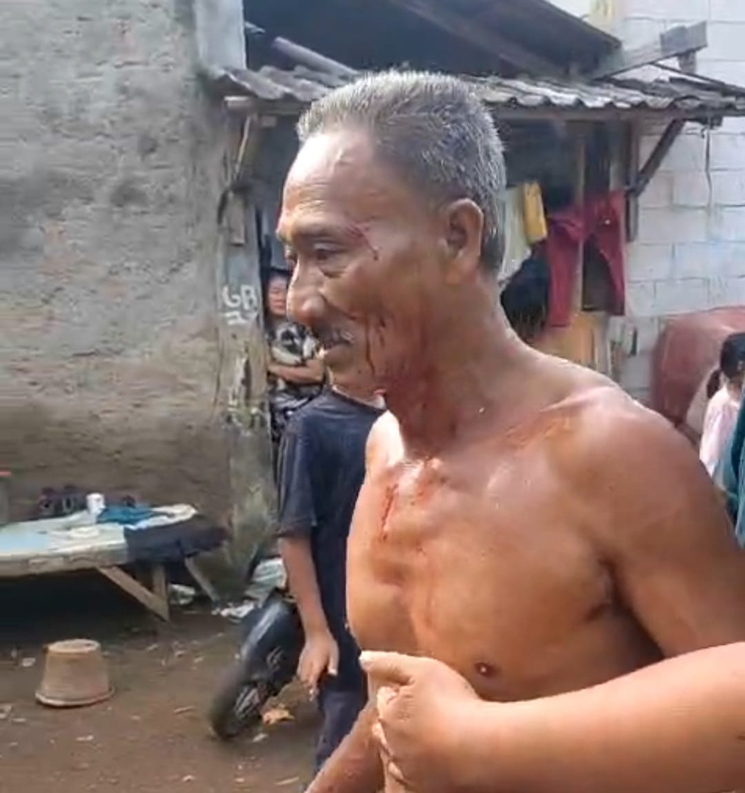 Breaking News! Penganiayaan Mandor Boyong Oleh Oknum TNI sampai berdarah - darah Breaking News! Penganiayaan Mandor Boyong Oleh Oknum TNI sampai berdarah - darah