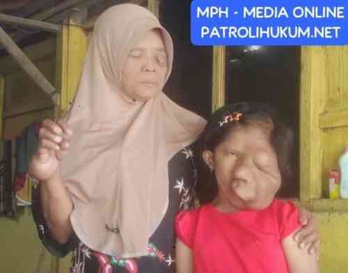 Mohon Bantuan ke Presiden RI Prabowo Subianto. Ibu & Anak Di Sragen Berjuang Melawan Kanker di Tengah Himpitan Ekonom Mohon Bantuan ke Presiden RI Prabowo Subianto. Ibu & Anak Di Sragen Berjuang Melawan Kanker di Tengah Himpitan Ekonom